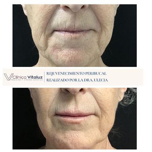 Clínica De Medicina Estética Vitaluz