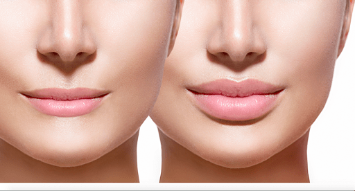 Clinica Estética Barcelona Vicario