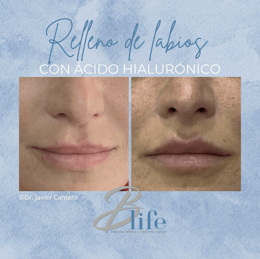 Negocio Clinica Estética Blife Madrid