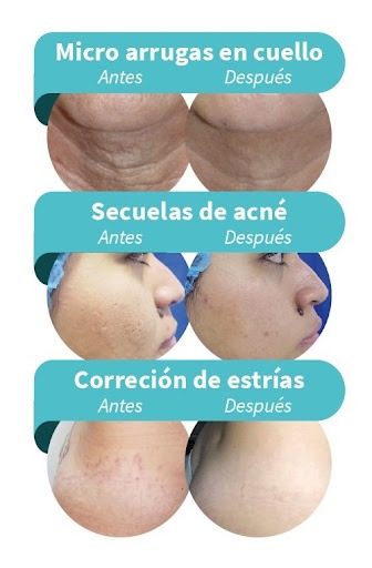 Negocio Clinica Medicina Estetica Y Tattoo Sacred Baza
