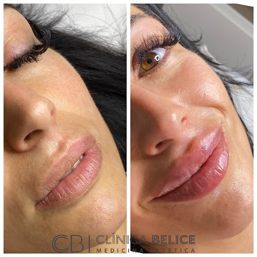 Negocio Clínicas De Medicina Estética En Valencia | Clínica Belice