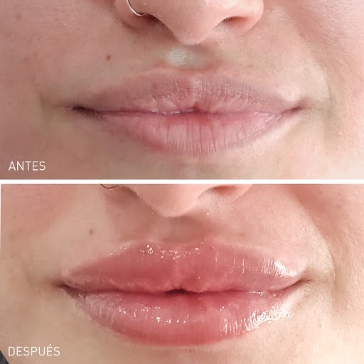 Clínicas Dh - C. De Dolores Marqués | Medicina Estética Y Depilación Láser