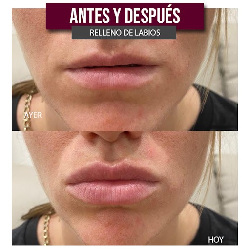 Clinicas Dh Medicina Estetica Y Depilacion Laser