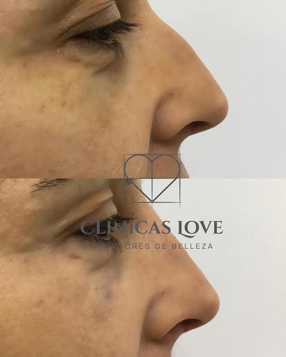 Negocio Clínicas Love | Cirugía Y Medicina Estética