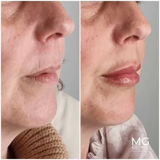 Negocio Mg Clinic | Clínica De Estética Y Cirugía Madrid